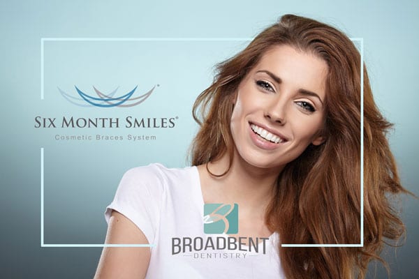 6 Month Smiles Ad